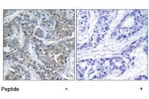 Image no. 1 for anti-Stathmin 1 (STMN1) (Ser15) antibody (ABIN197474) (Stathmin 1 抗体  (Ser15))
