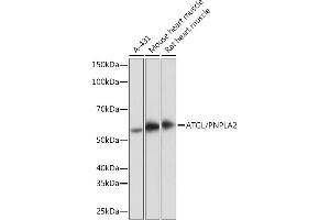 Western blot analysis of extracts of various cell lines, using ATGL/PNPL antibody (ABIN7269183) at 1:1000 dilution. (PNPLA2 抗体)