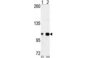 Western Blotting (WB) image for anti-EPH Receptor A4 (EPHA4) antibody (ABIN2927880) (EPH Receptor A4 抗体)