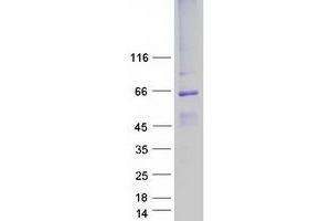 Western Blotting (WB) image for Bestrophin 1 (BEST1) (Transcript Variant 1) protein (Myc-DYKDDDDK Tag) (ABIN2715224)