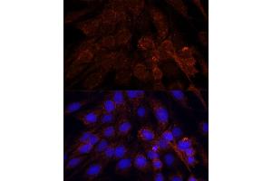 Immunofluorescence analysis of C6 cells using POLRMT antibody (ABIN7269460) at dilution of 1:100. (POLRMT 抗体  (AA 42-230))