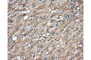 Immunohistochemical staining of paraffin-embedded prostate tissue using anti-CAPZA1 mouse monoclonal antibody. (CAPZA1 抗体)