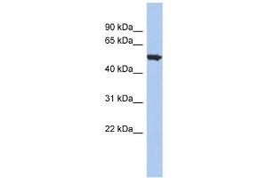 ACCN1 antibody used at 1 ug/ml to detect target protein. (ACCN1 抗体)