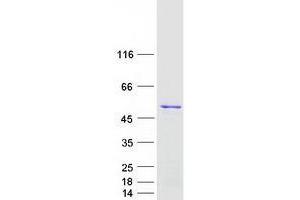 Trnt1 Protein (Transcript Variant 1) (Myc-DYKDDDDK Tag)