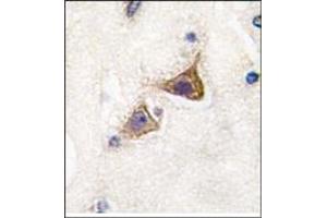 Image no. 2 for anti-Junctophilin 3 (JPH3) (Middle Region) antibody (ABIN357848) (Junctophilin 3 抗体  (Middle Region))