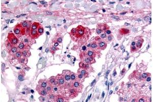 Human Adrenal (formalin-fixed, paraffin-embedded) stained with GPR182 antibody ABIN213455 at 6-9 ug/ml followed by biotinylated goat anti-rabbit IgG secondary antibody ABIN481713, alkaline phosphatase-streptavidin and chromogen. (G Protein-Coupled Receptor 182 抗体  (C-Term))