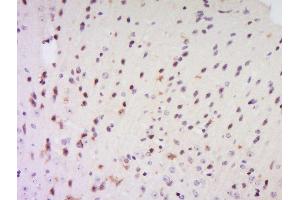 Formalin-fixed and paraffin embedded rat brain labeled with Anti-EXOSC7 Polyclonal Antibody, Unconjugated  at 1:200 followed by conjugation to the secondary antibody and DAB staining. (EXOSC7 抗体  (AA 21-120))