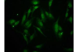 Immunofluorescence staining of Hela cells with ABIN7145800 at 1:266, counter-stained with DAPI. (BAZ2B 抗体  (AA 139-240))