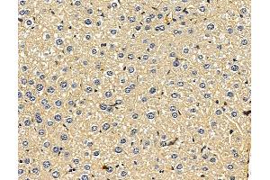 ABIN7096454 and ABIN7100518 at 1/100 staining mouse liver tissue by IHC-P. (UGT2B28 抗体)
