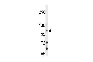 GUCY2F Antibody (C-term) (ABIN1537619 and ABIN2848622) western blot analysis in 293 cell line lysates (35 μg/lane). (GUCY2F 抗体  (C-Term))