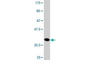 Western Blot detection against Immunogen (37. (HAPLN4 抗体  (AA 30-134))
