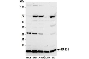 anti-Ribosomal Protein S28 (RPS28) (AA 19-69) antibody