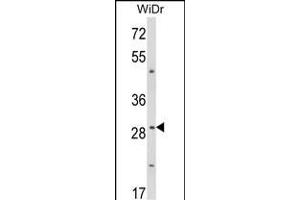 Western blot analysis of ZFP36 Antibody (Center) (ABIN652899 and ABIN2842580) in WiDr cell line lysates (35 μg/lane). (ZFP36 抗体  (AA 116-142))