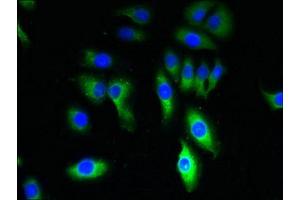 Immunofluorescent analysis of A549 cells using ABIN7172870 at dilution of 1:100 and Alexa Fluor 488-congugated AffiniPure Goat Anti-Rabbit IgG(H+L) (TRPM8 抗体  (AA 1-192))