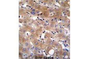 Immunohistochemistry (IHC) image for anti-Transient Receptor Potential Cation Channel, Subfamily M, Member 8 (TRPM8) antibody (ABIN2996363) (TRPM8 抗体)
