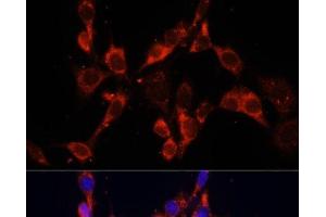 Immunofluorescence analysis of NIH/3T3 cells using DVL2 Polyclonal Antibody at dilution of 1:100. (DVL2 抗体)