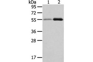 Western Blotting (WB) image for anti-XK, Kell Blood Group Complex Subunit-Related Family, Member 3 (XKR3) antibody (ABIN5962449) (XKR3 抗体)