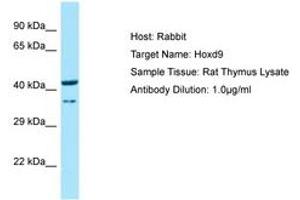 Image no. 1 for anti-Homeobox D9 (HOXD9) (N-Term) antibody (ABIN6749851) (HOXD9 抗体  (N-Term))
