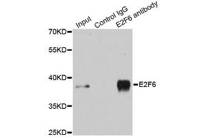 Immunoprecipitation analysis of 200ug extracts of MCF-7 cells using 3ug E2F6 antibody. (E2F6 抗体)