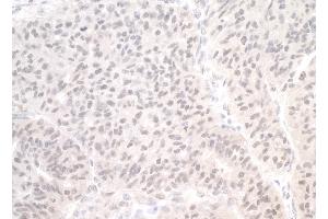 Immunohistochemistry (IHC) image for anti-Protein-L-Isoaspartate (D-Aspartate) O-Methyltransferase (PCMT1) (AA 150-200) antibody (ABIN7448726)
