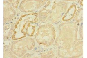 Immunohistochemistry of paraffin-embedded human kidney tissue using ABIN7166755 at dilution of 1:100 (DHX32 抗体  (AA 301-500))