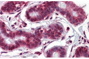 Immunohistochemistry (IHC) image for anti-Notch 4 (NOTCH4) (Middle Region) antibody (ABIN2777550)