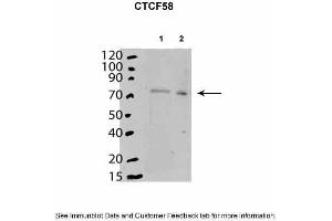 Mouse stem cells expressed in cytoplasm and nucleoplasm. (CTCF 抗体  (C-Term))