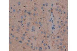 Used in DAB staining on fromalin fixed paraffin- embedded brain tissue (DLG5 抗体  (AA 1724-1917))