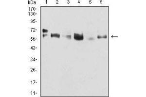 Western blot analysis using CK5 mouse mAb against A431 (1), MCF-7 (2), SK-Br-3 (3), Hela (4), Lncap (5), and HepG2 (6) cell lysate. (Cytokeratin 5 抗体  (AA 258-357))