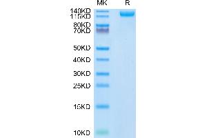 SDS-PAGE (SDS) image for SARS-CoV-2 Spike S1 (N501Y) protein (His tag) (ABIN7274394)