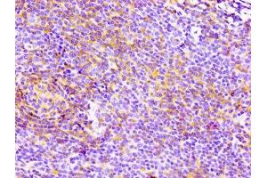 IHC image of ABIN7127280 diluted at 1:100 and staining in paraffin-embedded human lymph node tissue performed on a Leica BondTM system. (Recombinant CD4 抗体)