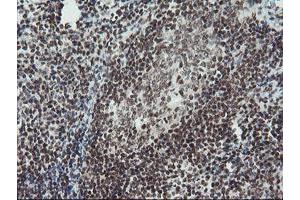 Image no. 6 for anti-TP53RK Binding Protein (TPRKB) antibody (ABIN1501484)