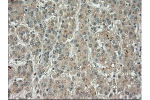 Image no. 10 for anti-Budding Uninhibited By Benzimidazoles 1 Homolog beta (Yeast) (BUB1B) antibody (ABIN1497000) (BUB1B 抗体)