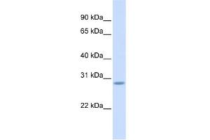 WB Suggested Anti-SCRT2 Antibody Titration:  0. (SCRT2 抗体  (Middle Region))
