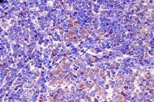 Immunohistochemistry analysis of paraffin-embedded mouse prefrontal lobe using GPR83 (ABIN7074000) at dilution of 1: 800 (GPR83 抗体)