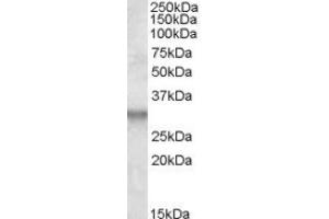 Image no. 1 for anti-Integral Membrane Protein 2B (ITM2B) (Internal Region) antibody (ABIN375095) (ITM2B 抗体  (Internal Region))