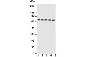 Western blot testing of ABCG5 antibody and Lane 1:  MCF-7;  2: A549;  3: HT1080;  4: U87;  5: SKOV cell lysate. (ABCG5 抗体  (N-Term))