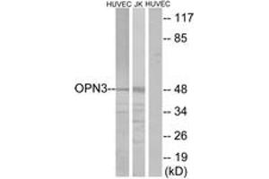 Western blot analysis of extracts from HuvEc/Jurkat cells, using OPN3 Antibody. (OPN3 抗体  (AA 161-210))