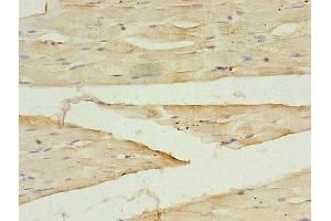 Immunohistochemistry of paraffin-embedded human skeletal muscle tissue using ABIN7149554 at dilution of 1:100 (DAPK2 抗体  (AA 222-370))