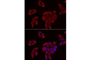 Immunofluorescence analysis of U2OS cells using P2RX4 antibody. (P2RX4 抗体)