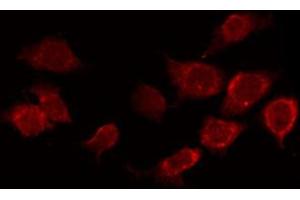 ABIN6267388 staining Hela by IF/ICC. (ATF2 抗体  (pSer94, pSer112))