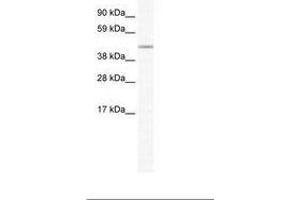 Image no. 1 for anti-Forkhead Box D1 (FOXD1) (AA 116-165) antibody (ABIN202563) (FOXD1 抗体  (AA 116-165))