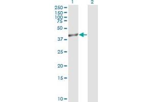 Western Blot analysis of TRIB3 expression in transfected 293T cell line by TRIB3 monoclonal antibody (M05), clone 2F7. (TRIB3 抗体  (AA 56-145))