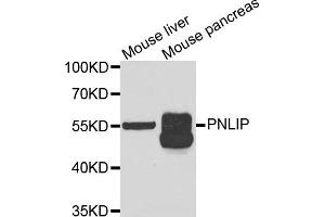 Western blot analysis of extracts of mouse liver and mouse pancreas cell lines, using PNLIP antibody. (PNLIP 抗体)