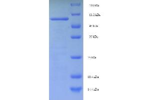 SDS-PAGE (SDS) image for MutS Homolog 6 (E. Coli) (MSH6) (AA 1-400), (partial) protein (His-SUMO Tag) (ABIN5709969)