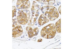Immunohistochemistry of paraffin-embedded human stomach using BMPR2 antibody (ABIN7265906) at dilution of 1:100 (40x lens). (BMPR2 抗体  (AA 27-150))
