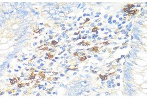 Immunohistochemistry of paraffin-embedded Human appendix using TPSAB1 Polyclonal Antibody at dilution of 1:100 (40x lens). (TPSAB1 抗体)