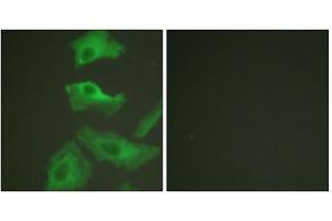 Immunofluorescence analysis of HeLa cells, treated with TNF-a (20nM, 15mins), using HSP90B (epitope around residue 254) antibody (ABIN5976154). (HSP90AB1 抗体  (Ser254))
