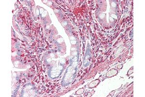 Anti-VEGFC antibody IHC staining of human small intestine. (VEGFC 抗体  (AA 1-290))