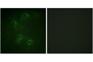 Immunofluorescence analysis of COS7 cells, using DAPK1 (Ab-308) Antibody. (DAP Kinase 1 抗体  (AA 274-323))